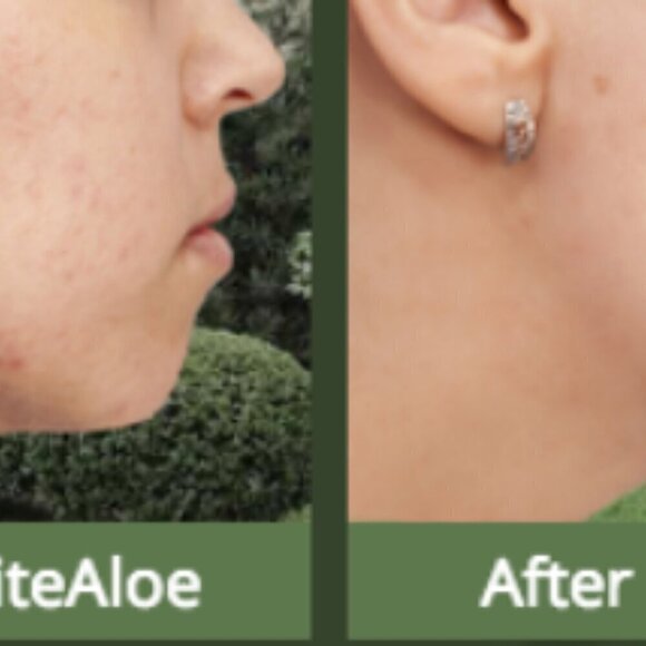 NEW! Infinite Aloe Everyday Hero Skincare Cream 8 OZ+ travel -Original Scent - Picture 11 of 14